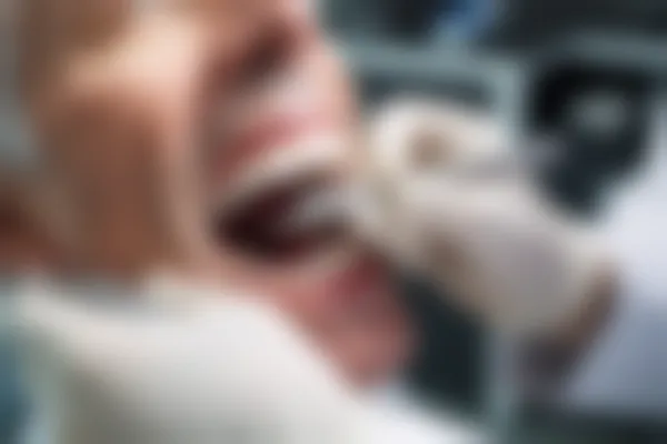 杭州泰康拜博口腔门诊部提供的高性价比口腔修复服务，价格仅从500元起起，现在优惠价仅需399元起，让您尽享优质的口腔修复体验！