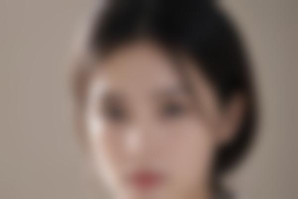 1、静萍胎记修复技术