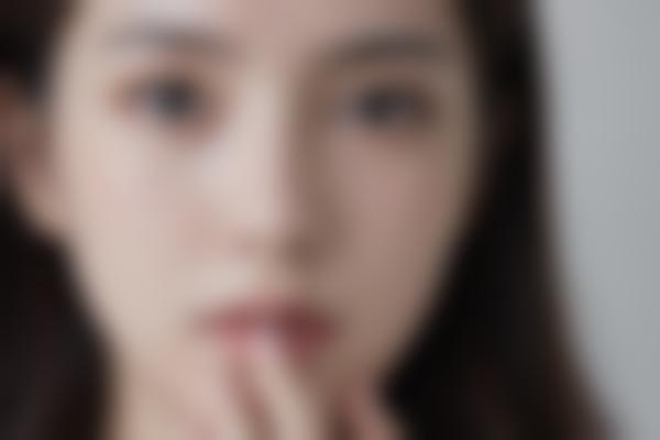 上海李强医生美眼整形技术解析，双眼皮修复与脂肪移植的