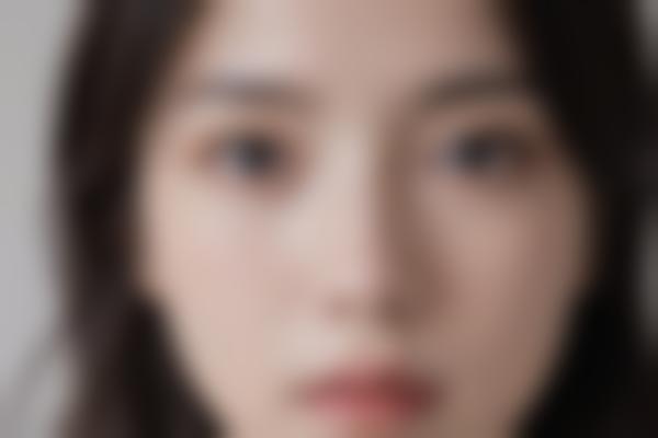 张莹莹医生整形技术怎么样？