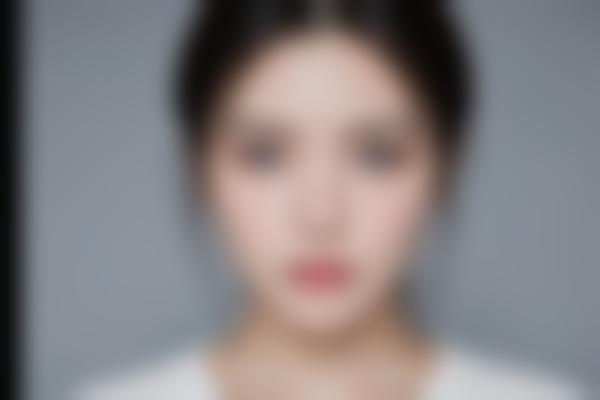 武汉医院曹玮医生整形修复技术解析，眼整形与整形