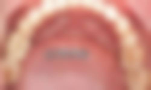 芜湖美雅尔口腔门诊部（无为米芾广场店）口碑评价与项目分享