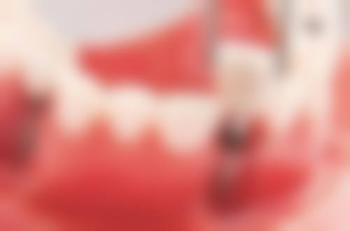 陕西汉中勉县文斌口腔价格表（仅供参考）