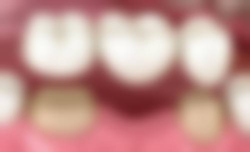 山东淄博士力口腔门诊(益洁口腔连锁)核心项目