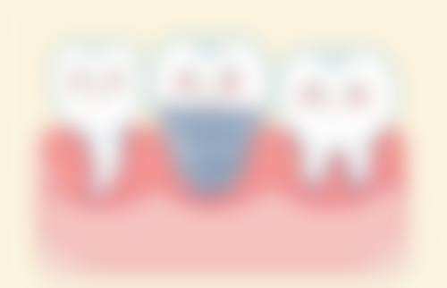 娄底蓝冠口腔门诊部价格表（仅供参考）