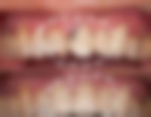 济南全好口腔（东关大街店）实例参考