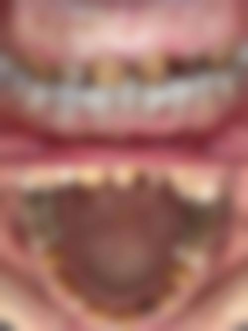 晋中雅康口腔(顺城店)怎么预约？