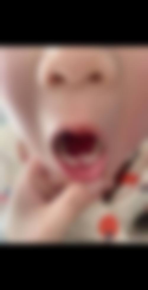 茌平一诺张合口腔诊所怎么预约？