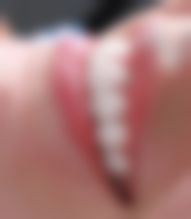 麦田口腔医院（岚山区）核心项目