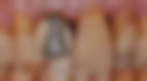 惠州彭新生口腔实例参考