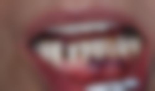 PatriciaSilva患者评价