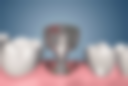 廊坊舒雅口腔怎么预约？