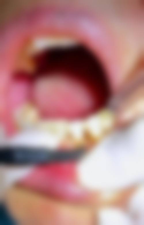 重庆牙管家口腔医院价格表(仅供参考)