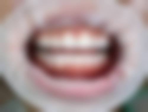 杭州岚盛口腔诊所实例参考