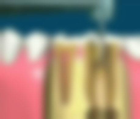 山东威海荣成杰晶口腔怎么预约?