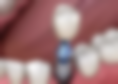 湖北武汉睿优口腔核心项目