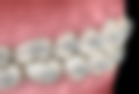 Tiago Estevao擅长项目列表