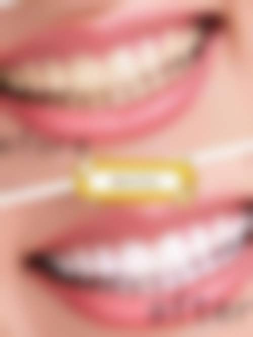 苏州国松牙之佳口腔实例参考