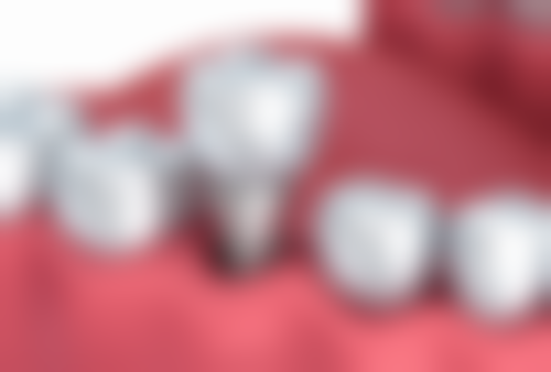 上海博蓉口腔价格表(仅供参考)