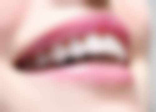 开福刘丰牙韵口腔诊所实例参考