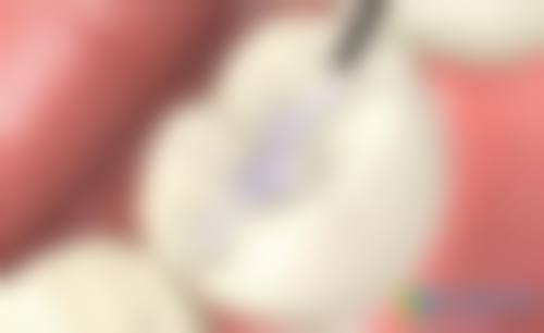 保山牙美佳口腔门诊价格表（仅供参考）