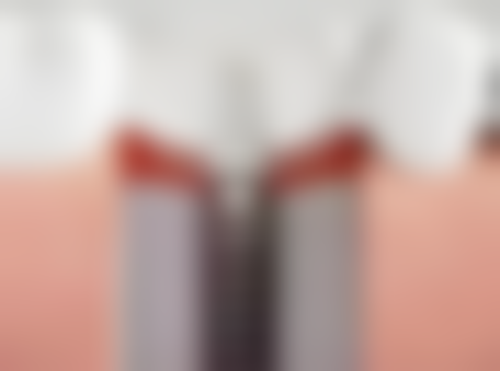 温州永嘉黄子练口腔实例参考