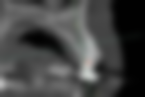 西宁星玉秀口腔诊所实例参考