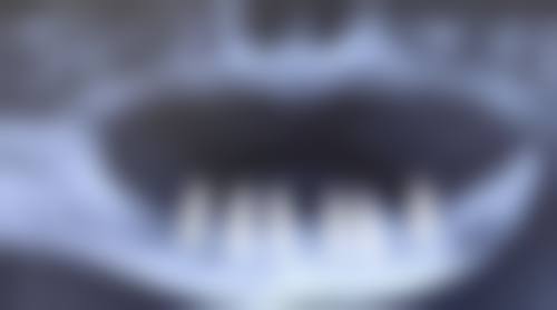 广东韶关皓齿口腔核心项目