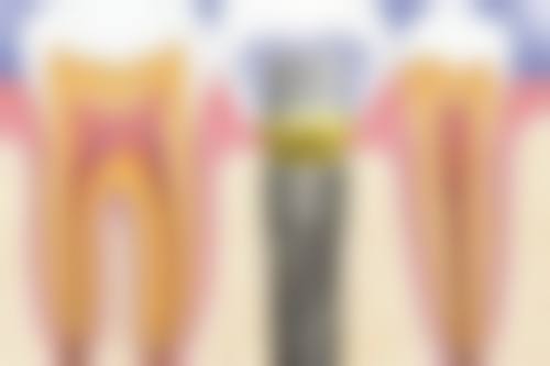 山东济南莱芜钢城张月平口腔核心项目