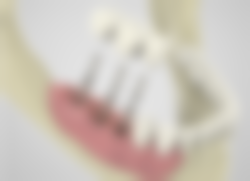 王子玉擅长项目列表