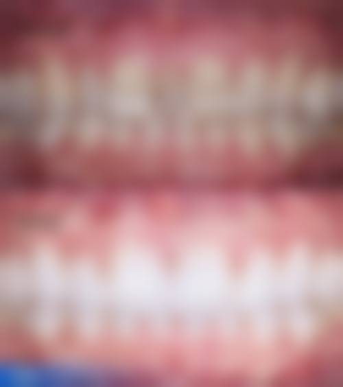 唐山市益齿口腔诊所(路北区)价格表（仅供参考）