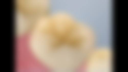 临沂市妇幼保健院口腔科怎么预约？