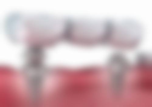 民权县新兴口腔实例参考