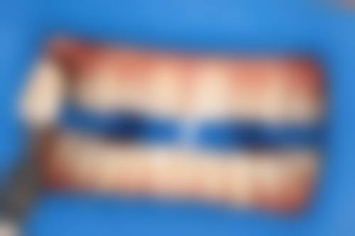 昆明乐美口腔医院映象小区口腔诊所核心项目