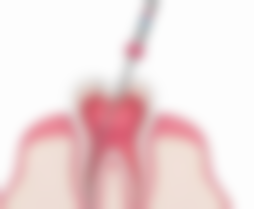 潍坊高新寨子口腔价格表（仅供参考）