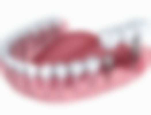 云南大理润泽口腔价格表(仅供参考)