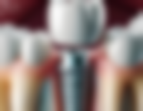 江苏苏州洁瑞口腔怎么预约？