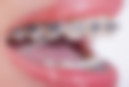 山东泰安凌雷口腔核心项目