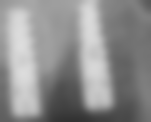 山东烟台孙周口腔连锁门诊部实例参考