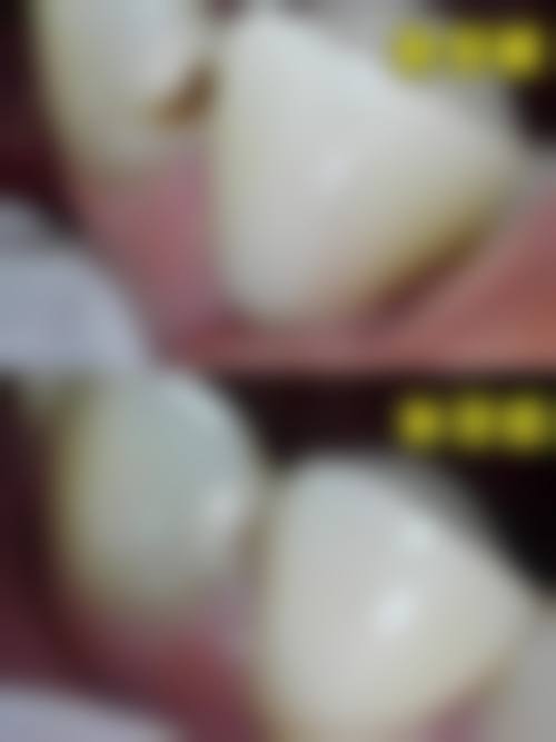 烟台雅康口腔诊所核心项目