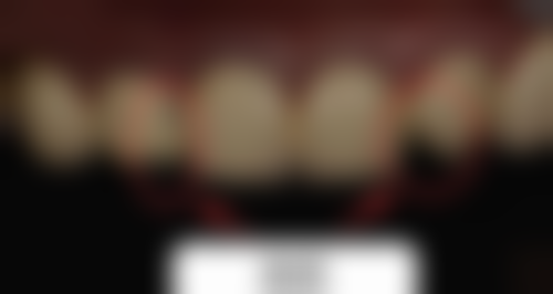 南京艾芽口腔门诊部实例参考