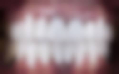 湖北荆州白桦口腔核心项目