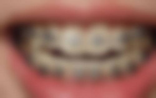 深圳横岗千喜口腔门诊部核心项目