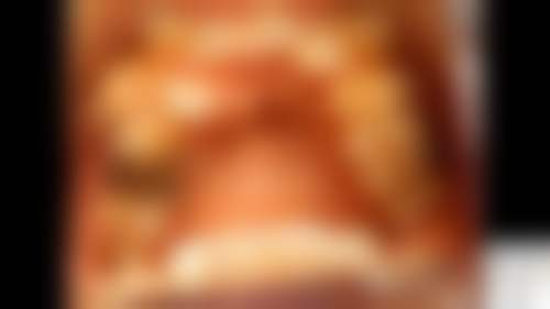 商丘植雅口腔医院价格表(仅供参考)