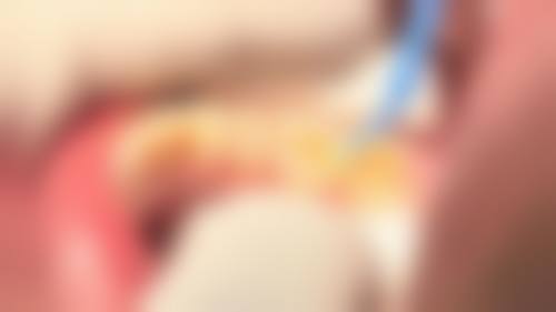 株洲美郡口腔(天元店)实例参考