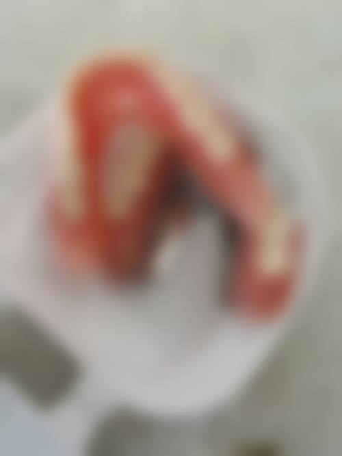 内蒙古自治区肿 瘤医院口腔科实例参考