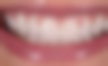 杭州下城口腔医院（文晖路分院）怎么预约？