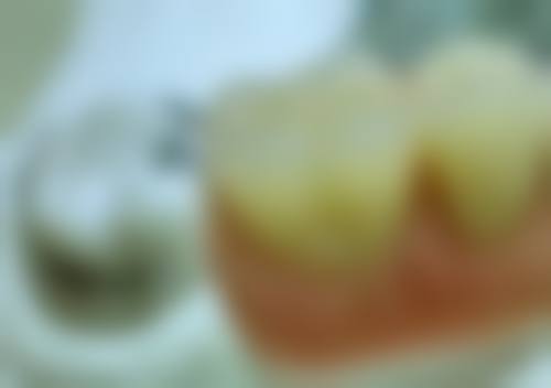 咸阳雅诺康口腔门诊部核心项目