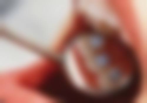 首都医 科 大学附属北京口腔医院口腔颌面整形创伤科实例参考