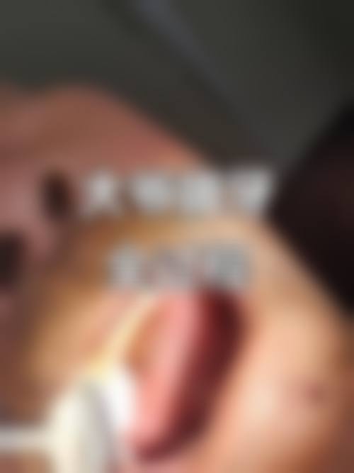 张玉涛预约方式